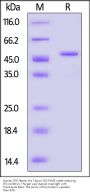 Human GSK-3beta / GSK-3β Protein, His Tag (active enzyme, HPLC verified)