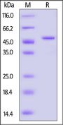 Human GSK-3beta / GSK-3β Protein, His Tag (active enzyme, HPLC verified)
