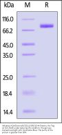 Influenza A [A/Darwin/6/2021 (H3N2)] Hemagglutinin (HA) Protein, His Tag (MALS verified)