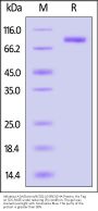 Influenza A [A/Darwin/9/2021 (H3N2)] Hemagglutinin (HA) Protein, His Tag (MALS verified)