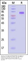 Influenza A (Guangdong/18SF020(H5N6)) Hemagglutinin (HA) Protein, His Tag