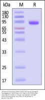 Influenza B [Austria/1359417/2021 (B/Victoria lineage)] Hemagglutinin (HA) Protein, His Tag