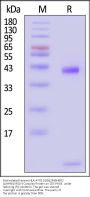 Biotinylated Human HLA-A*02:01&B2M&HER2 (LIAHNQVRQV) Complex Protein (Monomer, MALS verified)