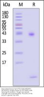 Biotinylated Human HLA-A*02:01&B2M&HER2 (KIFGSLAFL) Complex Protein (Monomer, MALS verified)