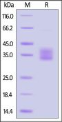 Human HLA-DQA1*03:02&DQB1*03:03 Monomer Protein (Peptide free)