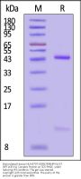 Biotinylated Human HLA-B*07:02&B2M&HPV16 E7 (KPTLKEYVL) Complex Protein (Monomer, MALS verified)
