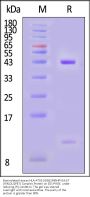 Biotinylated Human HLA-A*02:01&B2M&HPV16-E7 (YMLDLQPET) Complex Protein (Monomer, MALS verified)