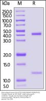 Biotinylated Human HLA-A*02:01&B2M&AFP (FMNKFIYEI) Complex Protein (Monomer, MALS verified)