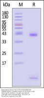 Biotinylated Human HLA-A*02:01&B2M&PSMA (MMNDQLMFL) Complex Protein (Monomer, MALS verified)