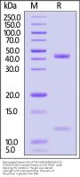 Biotinylated Human HLA-A*03:01&B2M&KRASG12C (VVGACGVGK) Complex Protein (Monomer, MALS verified)