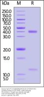 Human HLA-A*11:01&B2M&KRASG12D (VVGADGVGK) Complex Protein (Monomer, MALS verified)