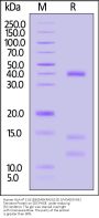 Human HLA-A*11:01&B2M&KRASG12D (VVGADGVGK) Tetramer Protein