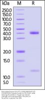 Biotinylated Human HLA-A*11:01&B2M&KRASG12D (VVGADGVGK) Complex Protein (Monomer, MALS verified)