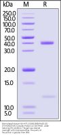 Biotinylated Human HLA-A*11:01&B2M&KRASG12D (VVVGADGVGK) Complex Protein (Monomer, MALS verified)