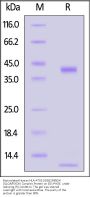 Biotinylated Human HLA-A*02:01&B2M&EW (QLQNPSYDK) Complex Protein (Monomer, MALS verified)
