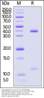 Biotinylated Human HLA-A*11:01&B2M&EBV (AVFDRKSDAK) Complex Protein (Monomer, MALS verified)