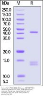 Human HLA-A*02:01&B2M&Glypican 3 (FVGEFFTDV) Tetramer Protein (MALS verified)