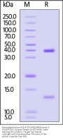 Biotinylated Human HLA-A*02:01&B2M&Glypican 3 (FVGEFFTDV) Complex Protein (Monomer, MALS verified)