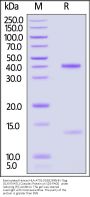 Biotinylated Human HLA-A*02:01&B2M&HIV Gag (SLYNTVATL) Complex Protein (Monomer, MALS verified)