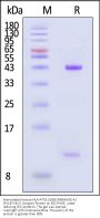 Biotinylated Human HLA-A*02:01&B2M&MAGE-A1 (KVLEYVIKV) Complex Protein (Monomer, MALS verified)
