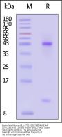 Biotinylated Human HLA-A*02:01&B2M&MAGE-A4 (GVYDGREHTV) Complex Protein (Monomer, MALS verified)
