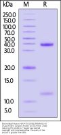 Biotinylated Human HLA-A*02:01&B2M&MAGE-A2 (YLQLVFGIEV) Complex Protein (Monomer, MALS verified)