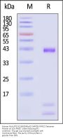 Human HLA-A*02:01&B2M&p53 (HMTEVVRRC) Tetramer Protein (MALS verified)