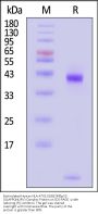 Biotinylated Human HLA-A*02:01&B2M&p53 (GLAPPQHLIRV) Complex Protein (Monomer, MALS verified)