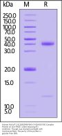 Human HLA-A*11:01&B2M&KRAS (VVGAGGVGK) Complex Protein (Monomer, MALS verified)