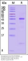 Biotinylated Human HLA-A*03:01&B2M&KRAS (VVVGAGGVGK) Complex Protein (Monomer, MALS verified)
