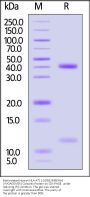 Biotinylated Human HLA-A*11:01&B2M&KRAS (VVGAGGVGK) Complex Protein (Monomer, MALS verified)