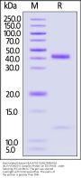 Biotinylated Human HLA-A*02:01&B2M&KRAS (KLVVVGAGGV) Complex Protein (Monomer, MALS verified)