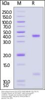 Biotinylated Human HLA-A*02:01&B2M&HBV (FLLTKILTI) Complex Protein (Monomer, MALS verified)