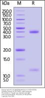 Human HLA-A*11:01&B2M&KRASG12V (VVGAVGVGK) Complex Protein (Monomer, MALS verified)