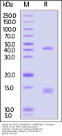 Human HLA-A*02:01&B2M&WT-1 (RMFPNAPYL) Tetramer Protein (MALS verified)