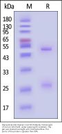Monoclonal Anti-Mumps virus HN Antibody, Human IgG1 (7D12) (MALS verified)