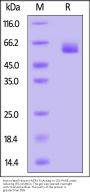 Biotinylated Human HVEM / TNFRSF14 Protein, Fc,Avitag™ (MALS verified)