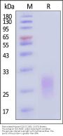 Biotinylated Human ICOS / CD278 (C136S, C137S) Protein, His,Avitag™ (recommended for biopanning)