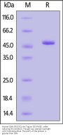Human IDH1 (R132C) Protein, His Tag (MALS verified)