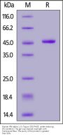 Human IFN-alpha 1 Protein, Fc Tag (MALS verified)