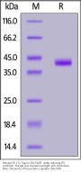 Mouse IGF-I Protein, Fc Tag (MALS verified)