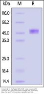 Human IgE Fc Protein, His Tag (MALS verified)