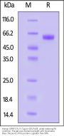 Human IGFBP-3 R / TMEM219 Protein, Fc Tag (MALS verified)