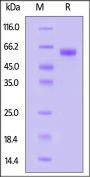 Human IGFBP-3 R / TMEM219 Protein, Fc Tag (MALS verified)