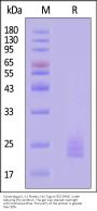 Cynomolgus IL-11 Protein, His Tag