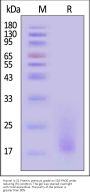 Human IL-31 Protein, premium grade