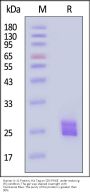 Human IL-11 Protein, His Tag