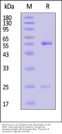 Anti-Human IL-15 (12B11E5) mAb, Mouse IgG1 (MALS verified)