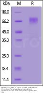 Mouse IL-15 R alpha / CD215 Protein, Fc Tag