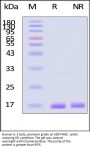 Human IL-1 beta / IL-1F2 Protein, premium grade